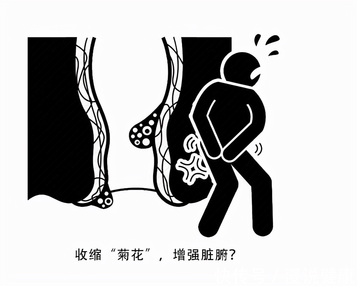 好处|日常提肛,预防痔疮?若能坚持这项运动,男性很快能得到3种好处