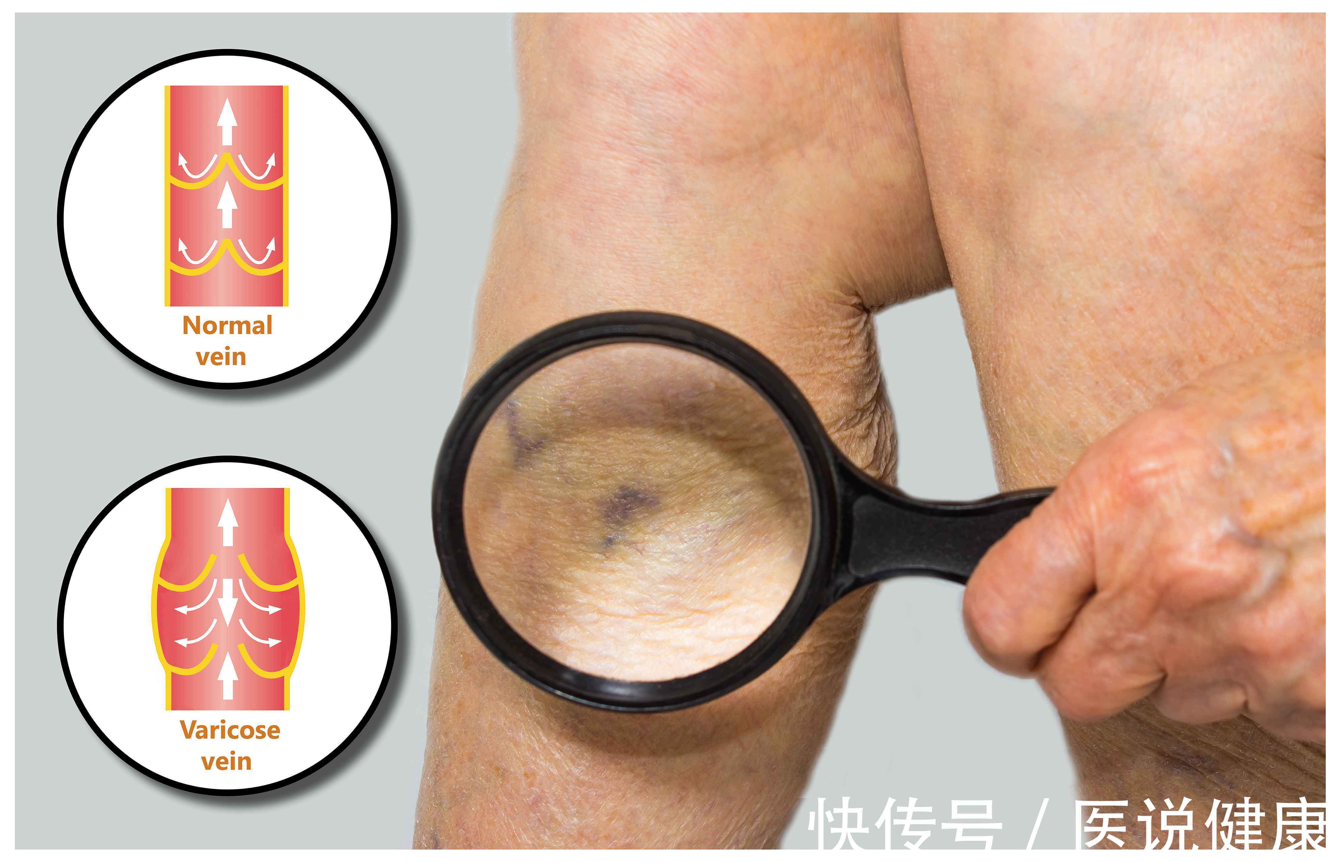 身体|血管堵塞,危害不容小觑,身体这6处会受到影响,需重视起来