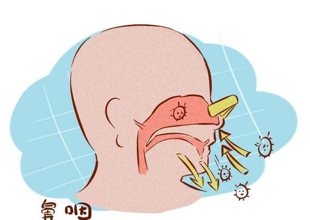 普志东|普志东:鼻咽癌为何会盯上你?