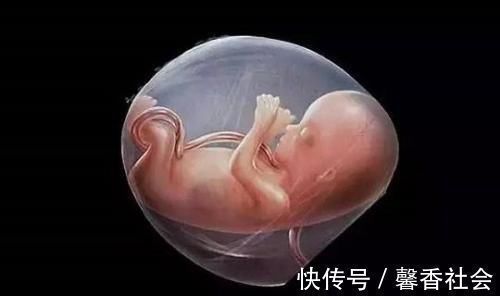 nt|如果胎儿智力有问题，孕妈在孕期有哪些特殊的症状？