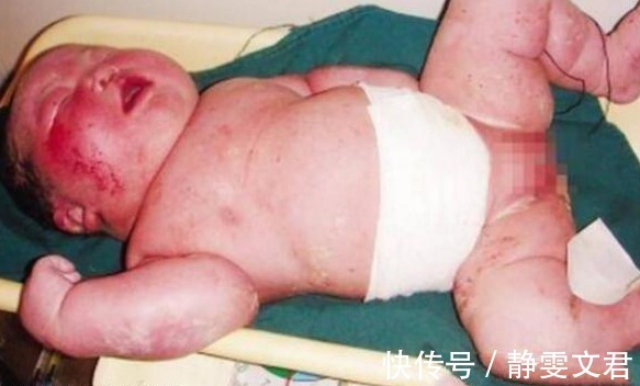 生死边缘|世界上最大婴儿出生,相当一个四五岁孩子,看到妈妈后彻底理解了