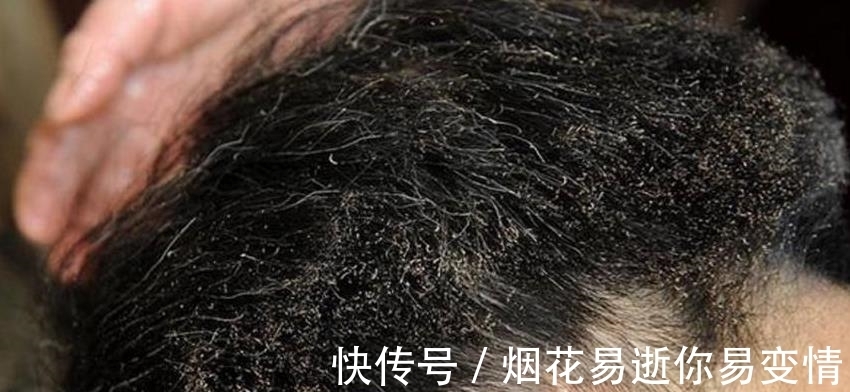 头发|男子用一把火钳给客人理发,头发都被烤糊了,排队的人却很多!