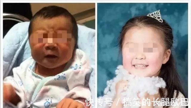 颜值|新生儿这3个部位越丑,长大后颜值越高,占一个就偷笑吧