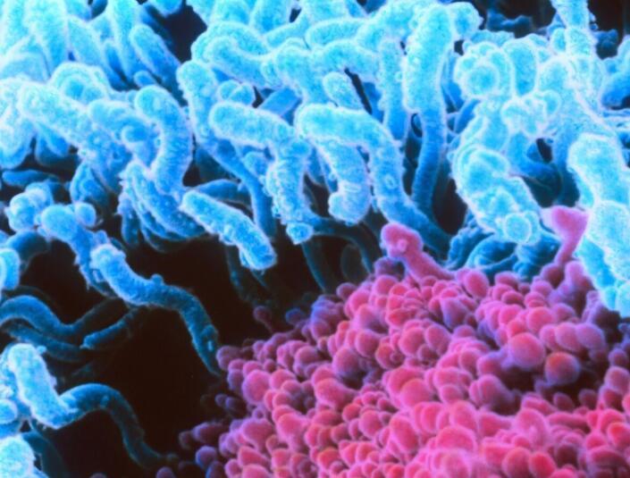 发性|小伙患上梅毒却不知情这些症状就是梅毒,有些人却不知道