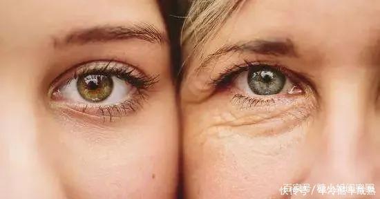 熬夜党也能不怕黑眼圈两个步骤教你拥有神采双眸!
