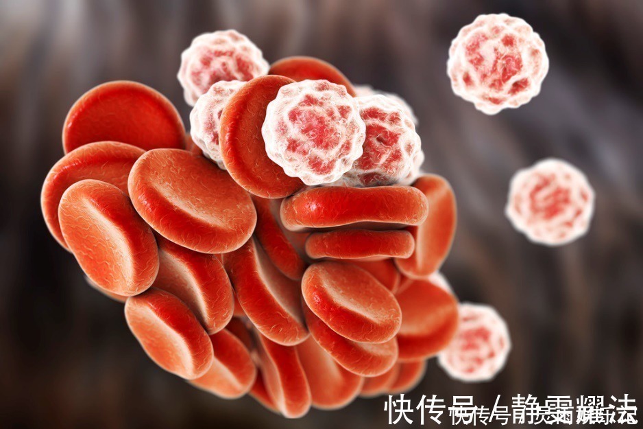 急性胰腺炎|改善高血脂其实可以不用吃药,医生提出2条实用建议,比药强多了