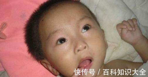 脑体|新生儿有这几种表现,可能是患上了脑瘫,做父母的不能大意!