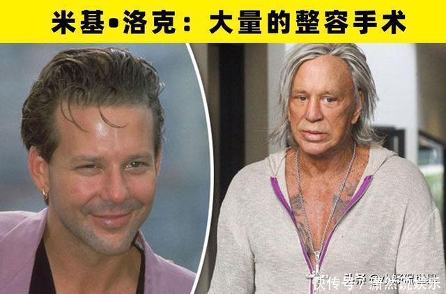 整容手术|大方承认自己做过整形手术的8名好莱坞明星