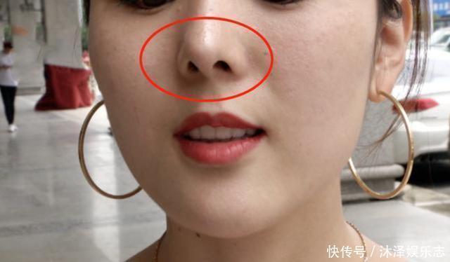 女主播花十几万整形,“鼻毛都能看见”,医院要求太高了!