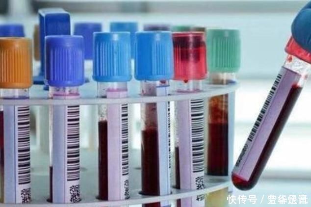 糖尿病|胰岛素“催化剂”找到了,比吃苦瓜管用,糖友敞开吃,血糖更稳定