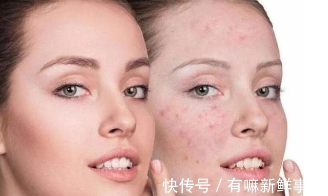 自我修护 如何提升皮肤的自我修护力避开这些护肤误区,皮肤才会越来越好!