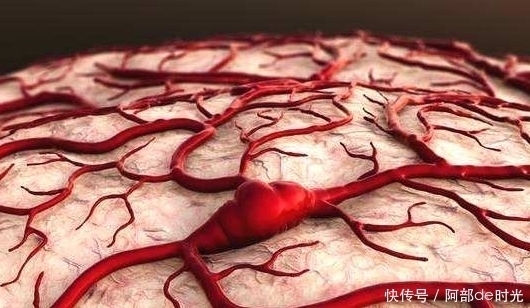 做菜的时|“脑淤血”现象逐渐增多,可能与常吃“它”有关,早知道早受益
