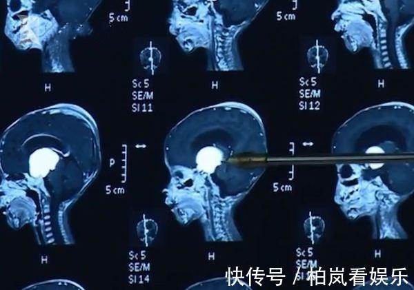 消瘦|因为一时疏忽，出生时8.8斤的宝宝一个月后骨瘦如柴，家长要警惕