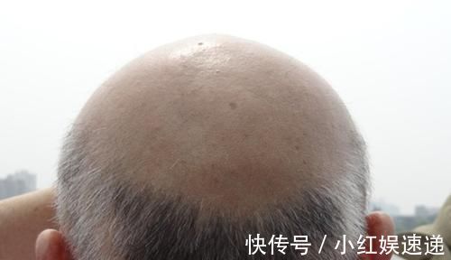 小肚腩|男人老没老，别只看年龄，身上有这些特征，应该要服老了