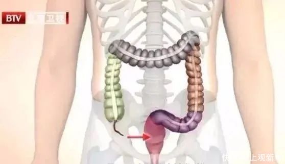 吃饭时的这5个坏习惯,会增加致癌、致死风险!