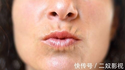 口香糖|如何擺脫臉頰脂肪:幫助你做到這一點的練習和技巧