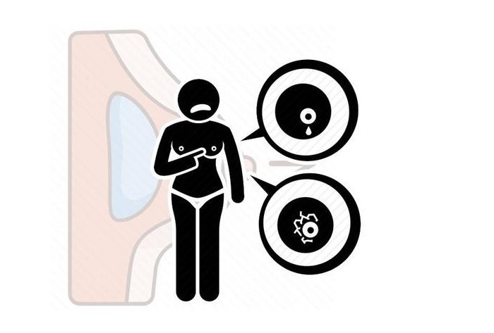 女性|女性呵护乳腺,预防乳腺增生!最好少做这5个行为,别给乳腺添堵