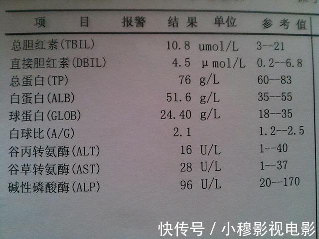 豆荚类|花生是肝病的“发物”？建议：转氨酶高的人，需要远离这几种食物