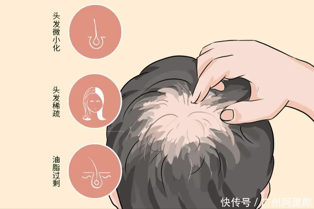  头发|#脱发救星#让头皮说话