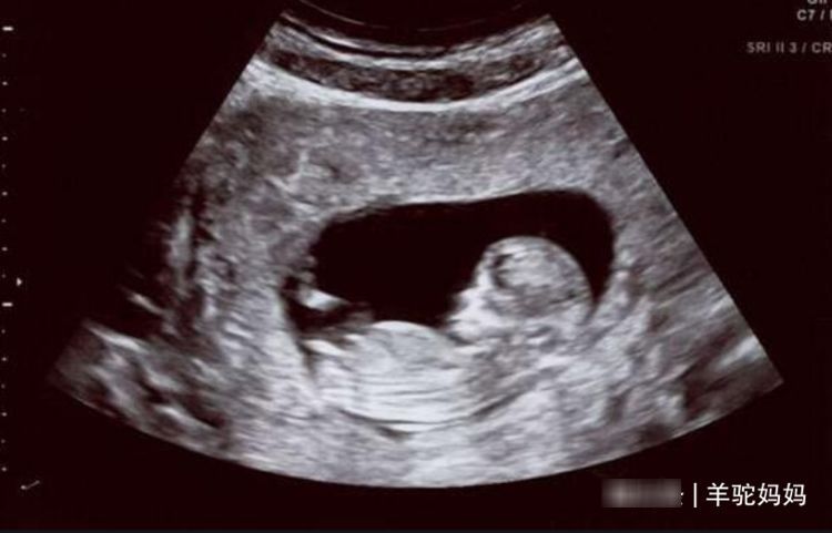 宝妈|在孕期若宝妈身上有这些现象，是宝宝在“报平安”，父母提前了解