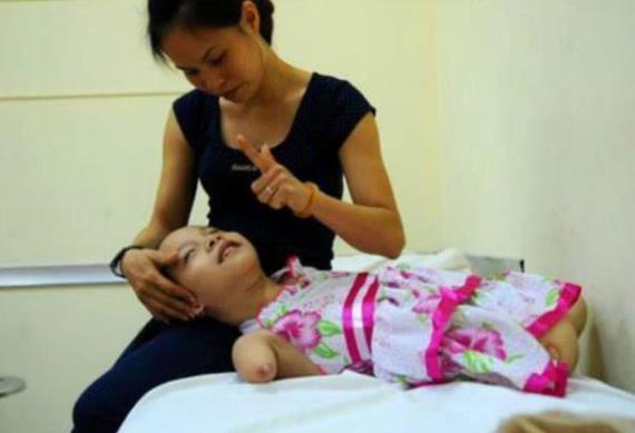 海豹胎|女生怀孕意外得知是“海豹胎”,医生劝其流产遭拒,5年后成这样