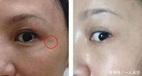 常喝的它,大娘用来敷脸。20天祛斑比女儿还年轻