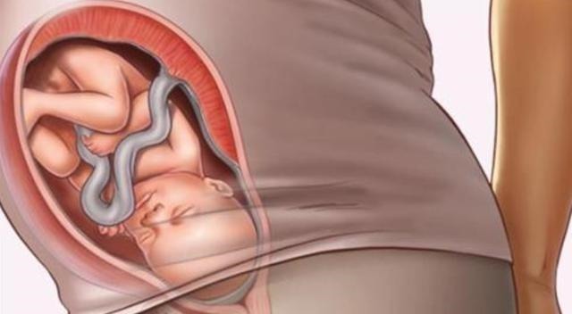 胎脂|孕期做到“4不碰”,有利于保持羊水“清澈”,胎儿住着更干净