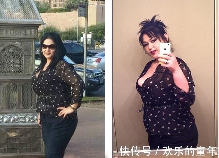 手术|1088斤胖女子经历2次手术,成功减掉648斤肥肉,堪称奇迹