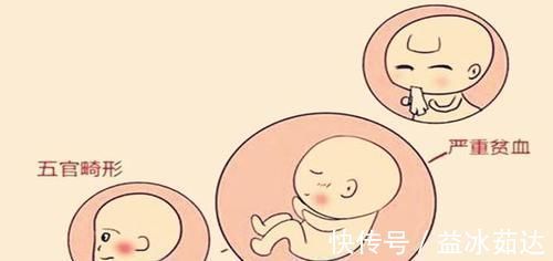 畸形|孕期胎儿畸形没有那么容易,孕妈做好这3点,胎宝宝会健康的出生