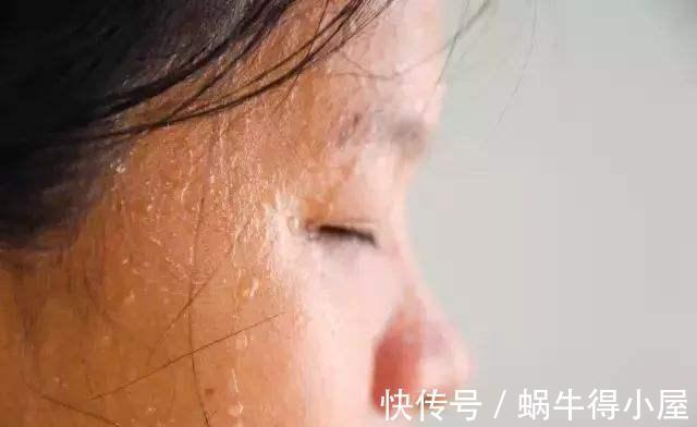 绝经|女性绝经前的5个异常,若在49岁左右显露,恭喜,卵巢保养得不错