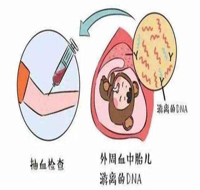 二胎|二胎宝宝35周了,一定要做无创或羊水穿刺吗?听听专家怎么说?
