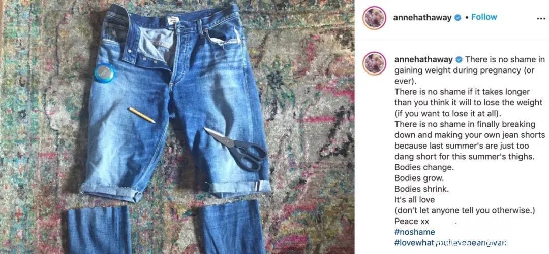 孕产妇|孕产妇蚂蚁腰,不必!