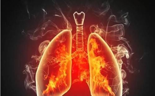 肝火|心火、胃火、肝火、肺火、肾火,一个4味药方,五脏之火通通扑掉