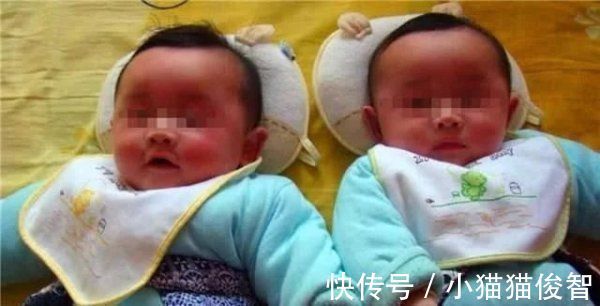 陈女士|备孕4年怀上双胞胎,孕检却说是连体婴,妈妈坚持生下后相拥而泣