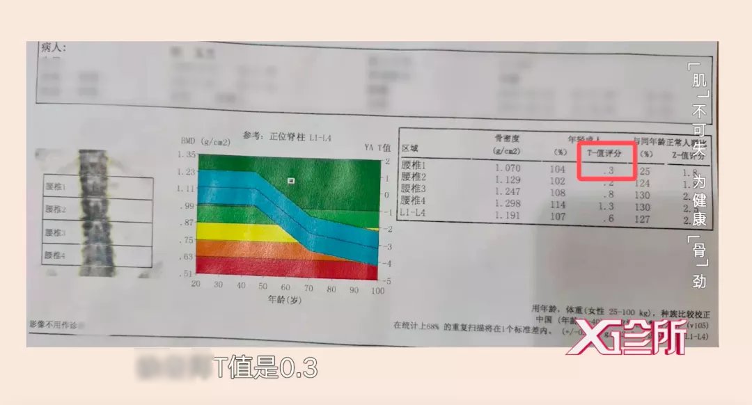 骨质疏松症|“肌”不可失！老年人跌倒的“幕后黑手”原来是TA！