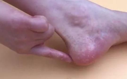 白糖倒在食用油中，解决了家家户户的困扰，学会受用一生