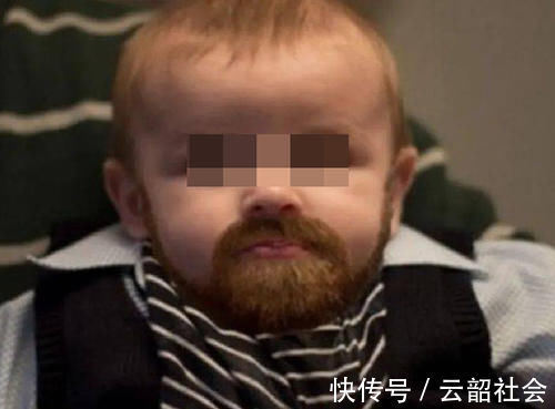 服用|孩子吃保健品吃成“性早熟”?这4类保健品娃不能碰,家长留点心