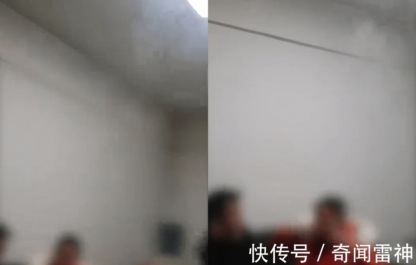 爱美之心 女子砍价2.6万做整容, 手术失败变“大妈”, 医院 效果也打折