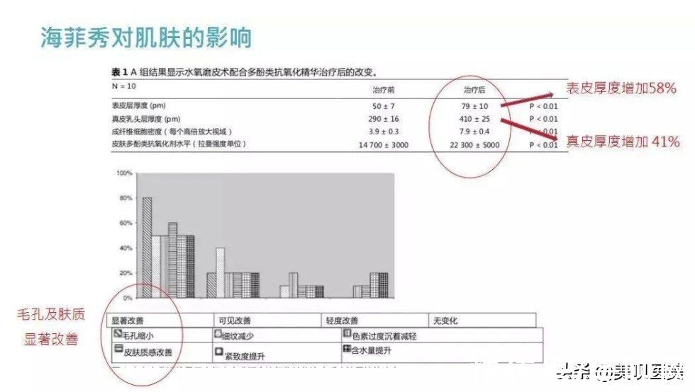 m22|医美无平替！4个小众贵妇级轻医美项目，谁做谁说值