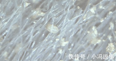 毛巾酸臭味从何而来别再用“臭毛巾”擦脸了!快来看看毛巾多脏