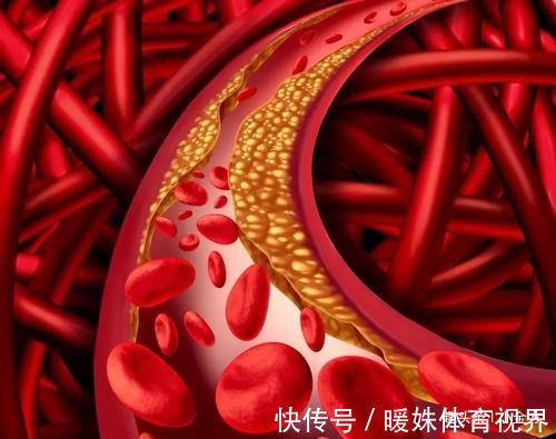 血管|养血管就是养命,40岁后多吃5大食物,不怕血管堵,寿命多十年