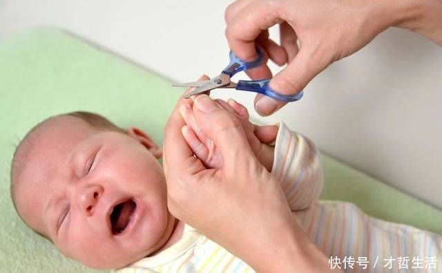 倒刺|指甲出现这4种情况,预示着宝宝的健康问题!宝妈赶紧检查一下