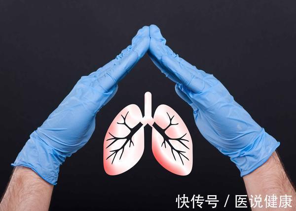 病变|反复出现4个症状,肺部或已发生“病变”,需及时检查