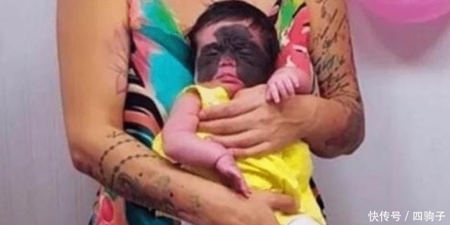 胎记|当年做8次整容手术,让人印象深刻的“蝙蝠侠女孩”,后来怎么样