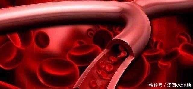 血管|血管干净人长寿,8种食物坚持吃,软化血管还能防血栓