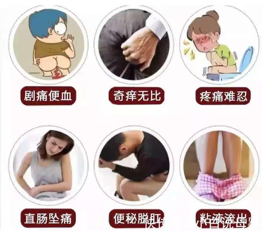 慎入|盐水洗痔疮居然好了?没想到痔疮竟然也有弱点,8年混合痔有救了