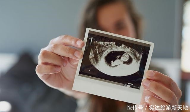 胎儿|孕期B超单直接反应胎儿状况,这5处孕妈要学会看懂,医生不会详说