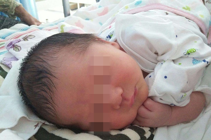 另一方面|攒肚or便秘,傻傻分不清?两者的症状不同,区分其实很简单