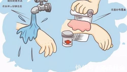 急救|4岁宝宝掉入170度油锅,奶奶3步救下孩子,医生:急救措施很专业