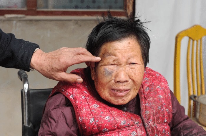 头晕头痛|60岁老人一年脑梗多次复发,医生1种粗粮吃1口等于吃10斤猪油